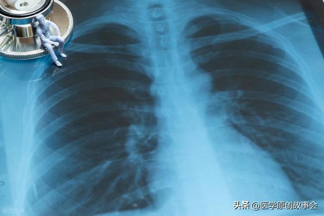 【深度警示】肺癌最易被忽视的五大转移信号，99%的人都踩过这个认知误区 健康养生