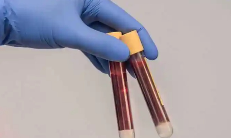  【深度拆解】低密度脂蛋白标准为何全面收紧：3.1mmol/L早已不是安全线 健康养生 【深度拆解】低密度脂蛋白标准为何全面收紧：3.1mmol/L早已不是安全线 健康养生